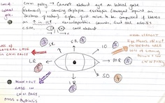 Cranial nerve palsy